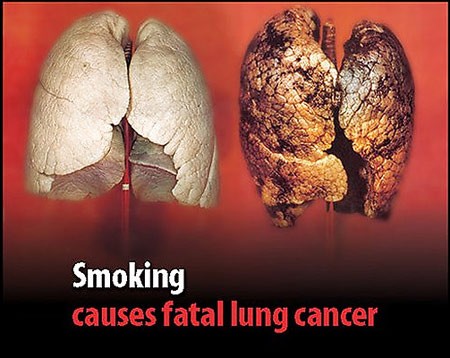 WHO warnt vor eventuell einer Milliarde Toten durch die Folgen von Tabakgenuß  - ảnh 1