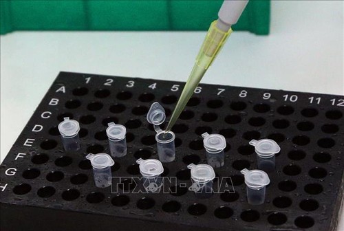 Veinte países solicitan kits de prueba rápida de coronavirus producidos por Vietnam - ảnh 1