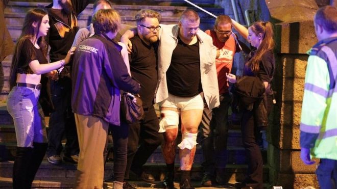 Police confirm suicide bombing after Manchester Arena explosion - ảnh 1