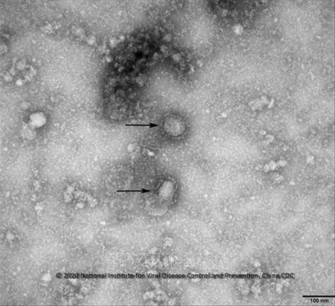 Китай сообщил о четвертой жертве нового коронавируса  - ảnh 1