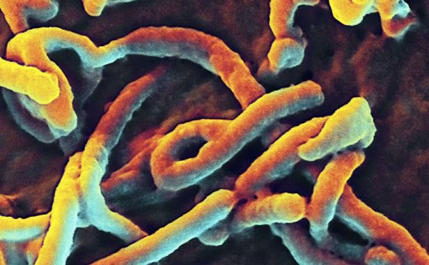 Ebola : Des Japonais annoncent un test de détection efficace en 30 minutes - ảnh 1