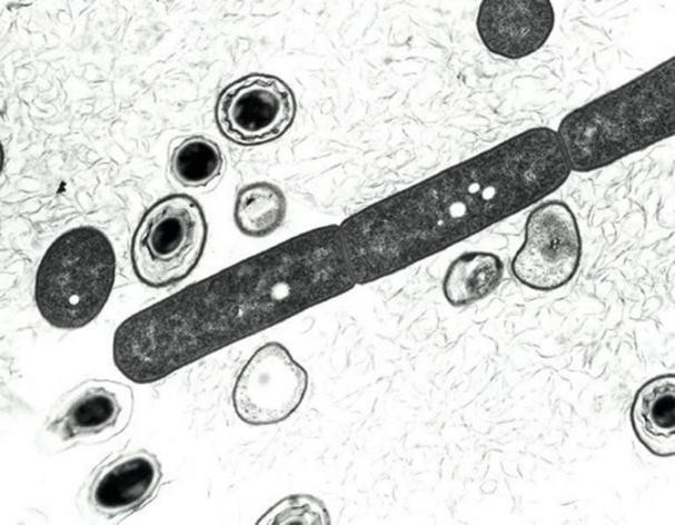 Le Pentagone reconnaît avoir envoyé par erreur de l'anthrax à plus de 50 labos - ảnh 1