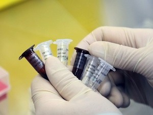 Virus H7N9 di Tiongkok tidak menular dari manusia ke manusia - ảnh 1