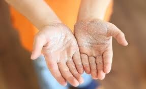 越南卫生部启动“护健康 - 勤洗手”活动 - ảnh 1