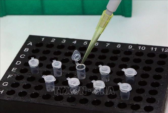 Zahlreiche Länder wollen SARS-CoV-2-Testkits Vietnams kaufen - ảnh 1