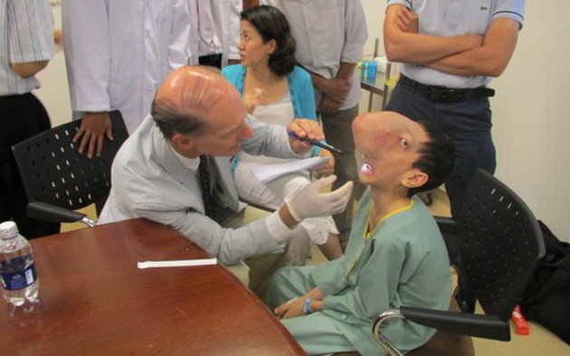 Bệnh viện Đa khoa Quốc tế Vinmec-Hà Nội phẫu thuật thành công tách khối u ác tính khổng lồ - ảnh 1
