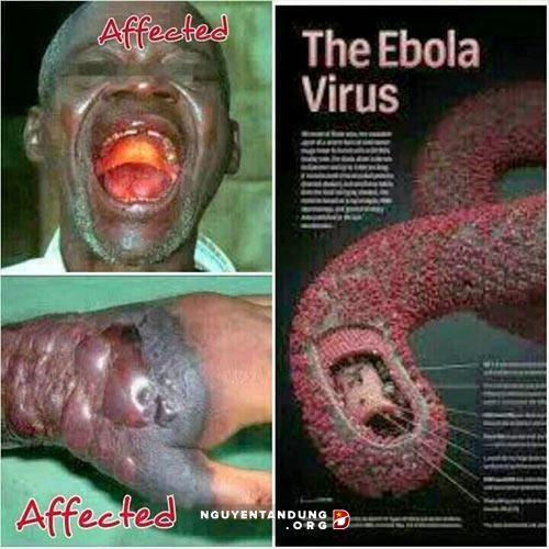 Melakukan semua langkah yang perlu untuk mencegah wabah yang ditimbulkan virus Ebola - ảnh 1
