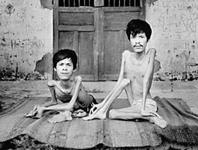 Triển lãm kỷ niệm 51 năm thảm họa da cam/dioxin Việt Nam - ảnh 1