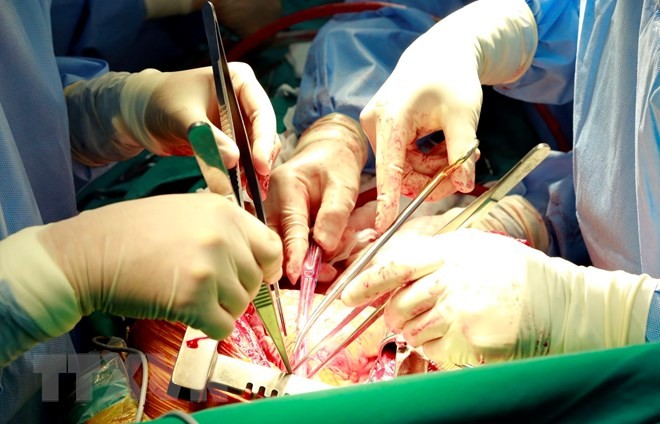 越南器官移植技术的进步 - ảnh 2