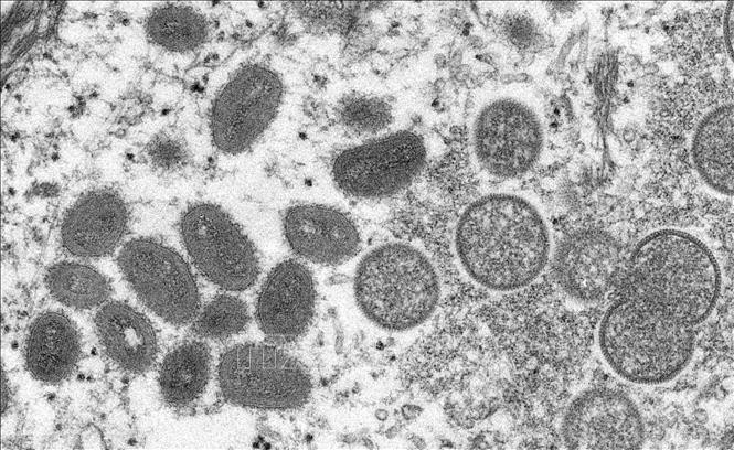 Face à la variole du singe, plusieurs pays européens durcissent les mesures sanitaires - ảnh 1