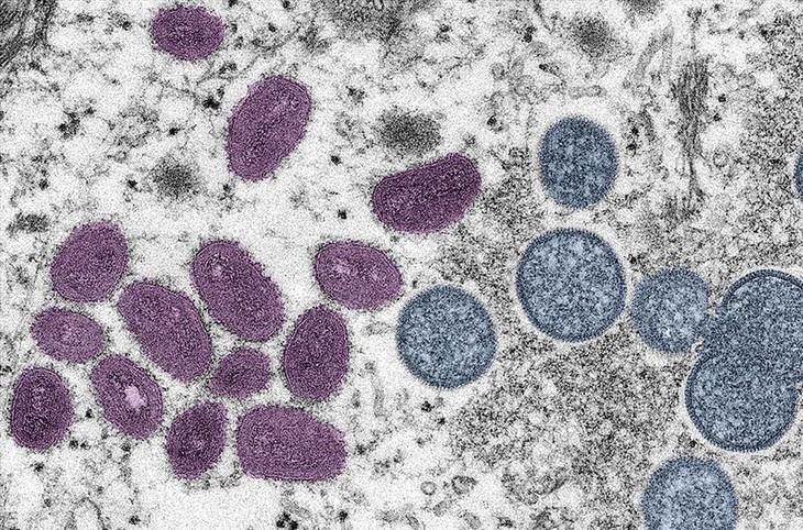 Un premier cas d’infection à la variole du singe confirmé au Vietnam - ảnh 1